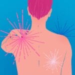 Recognizing The Early Signs Of Myopathy And Seeking Treatment