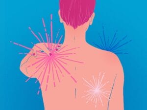 Recognizing The Early Signs Of Myopathy And Seeking Treatment