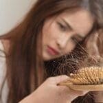 Top 4 Non-Surgical Best Hair Fall Treatment in Dubai You Can Try